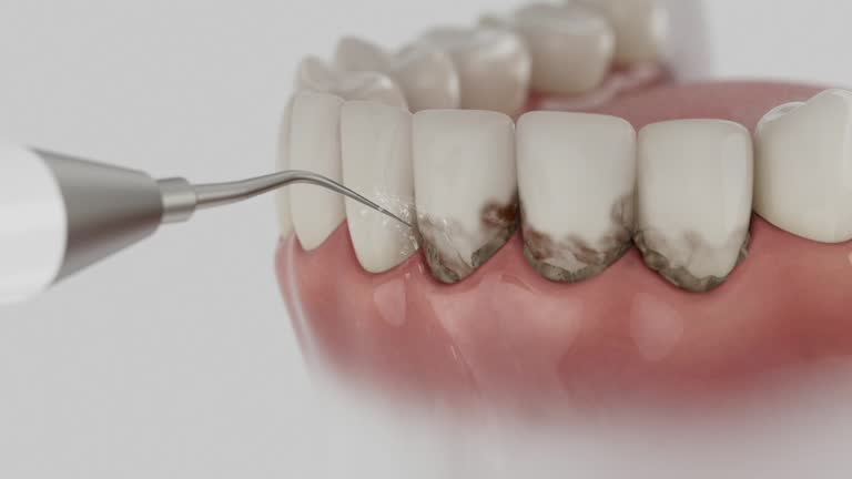 Trusted Dental Crowns And Bridges service in Clinton, NC - Dentist Open Now